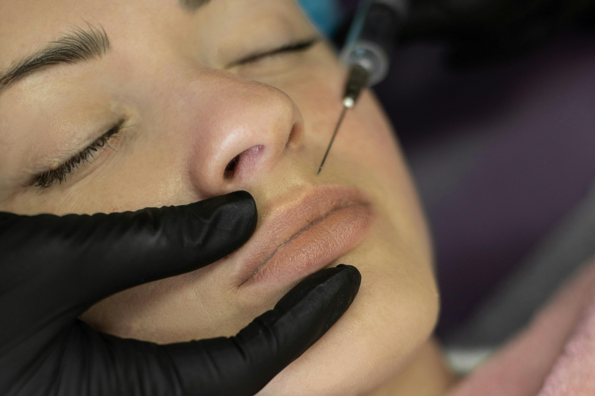 Sculptra Dermal Filler: How It Rebuilds Youthful Skin from Within